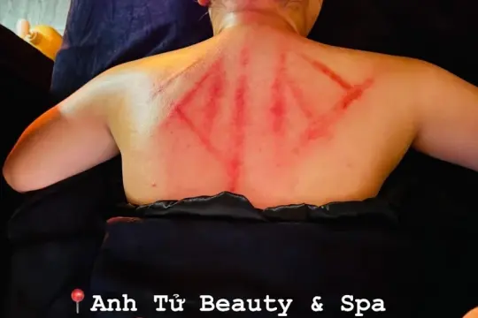 Anh Tu Beauty & Spa